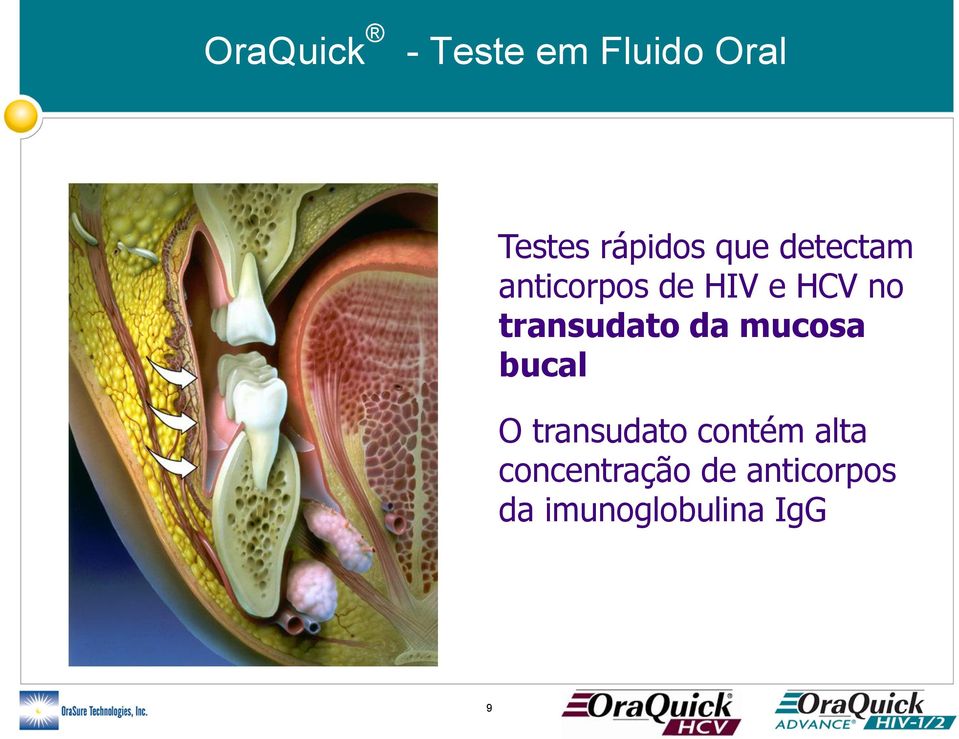 transudato da mucosa bucal O transudato contém