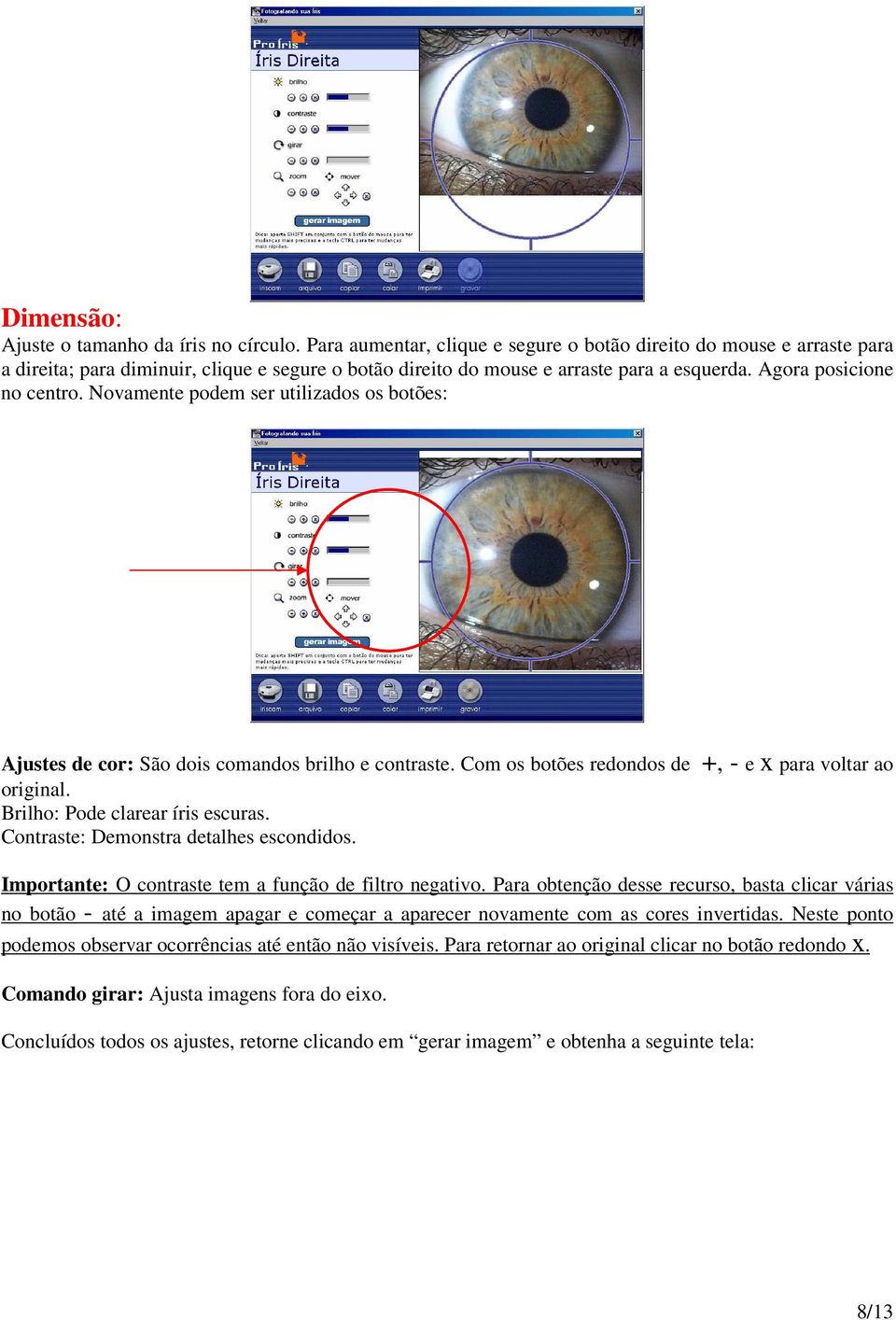 Novamente podem ser utilizados os botões: Ajustes de cor: São dois comandos brilho e contraste. Com os botões redondos de +, - e x para voltar ao original. Brilho: Pode clarear íris escuras.