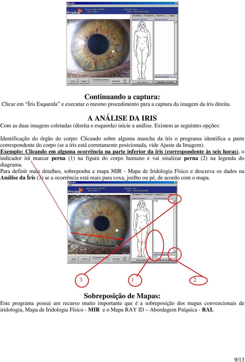 Existem as seguintes opções: Identificação do órgão do corpo: Clicando sobre alguma mancha da íris o programa identifica a parte correspondente do corpo (se a íris está corretamente posicionada, vide