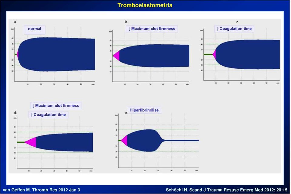 Thromb Res 2012 Jan 3