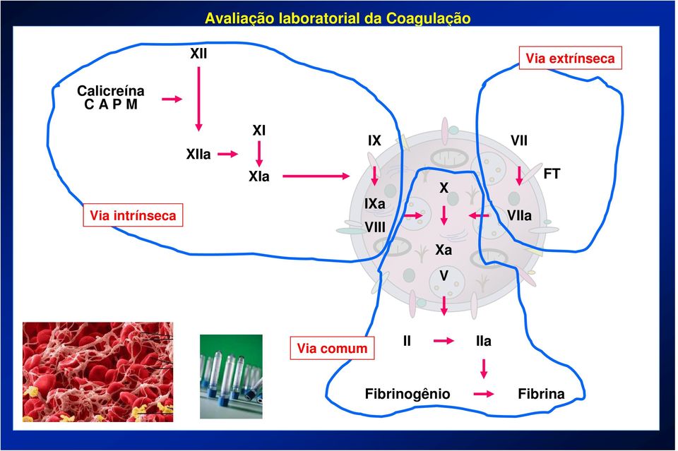 intrínseca XIIa XI XIa IX IXa VIII X VII