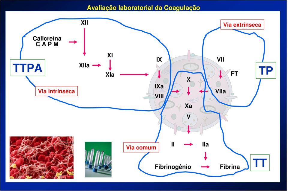 intrínseca XIIa XI XIa IX IXa VIII X VII VIIa