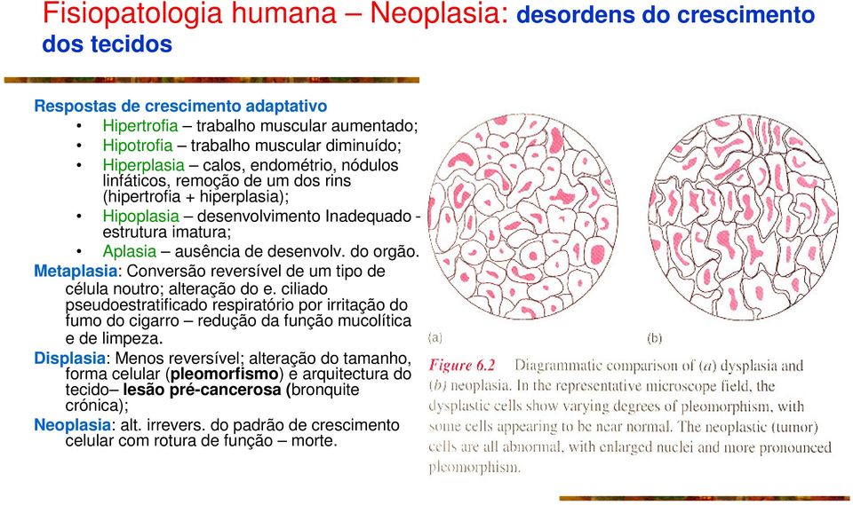 Metaplasia: Conversão reversível de um tipo de célula noutro; alteração do e. ciliado pseudoestratificado respiratório por irritação do fumo do cigarro redução da função mucolítica e de limpeza.