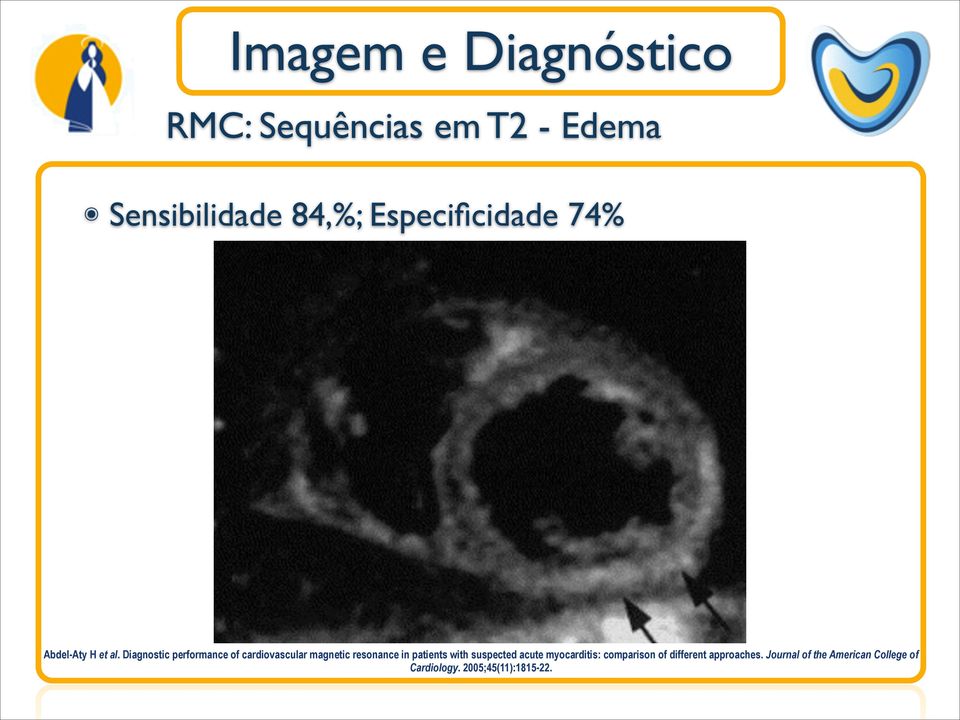 Diagnostic performance of cardiovascular magnetic resonance in patients with