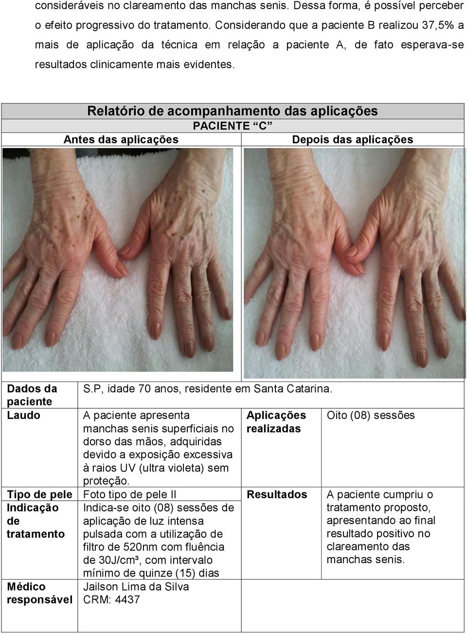 Relatório de acompanhamento das aplicações Antes das aplicações PACIENTE C Depois das aplicações Dados da paciente Laudo S.P, idade 70 anos, residente em Santa Catarina.