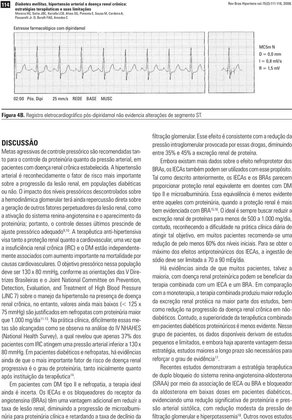 Registro eletrocardiográfico pós-dipiridamol não evidencia alterações de segmento ST.