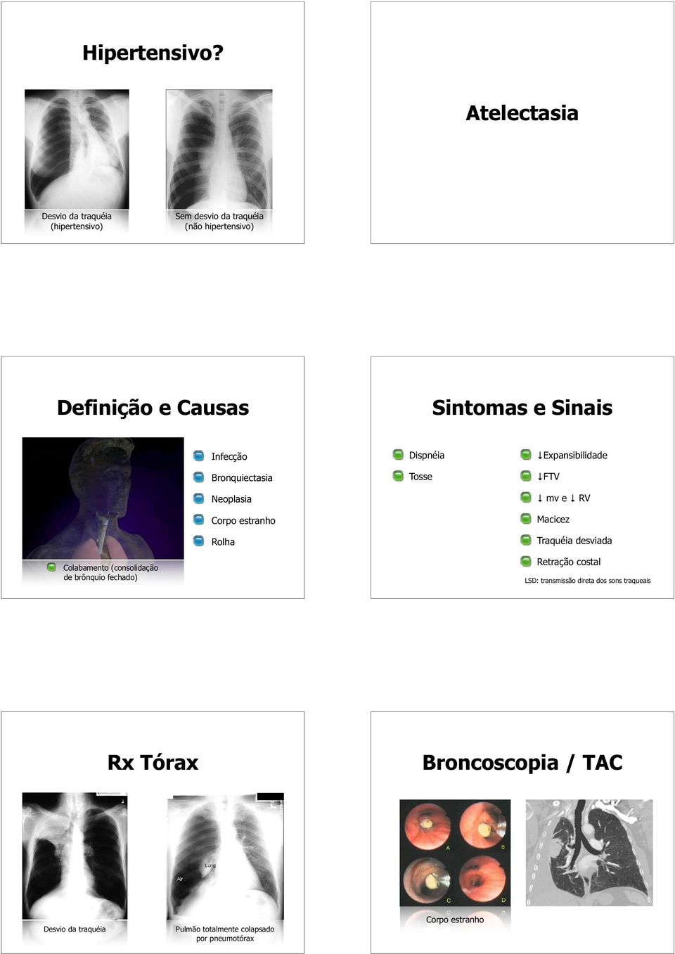 Infecção Bronquiectasia Neoplasia Corpo estranho Rolha Dispnéia Tosse Expansibilidade FTV mv e RV Macicez