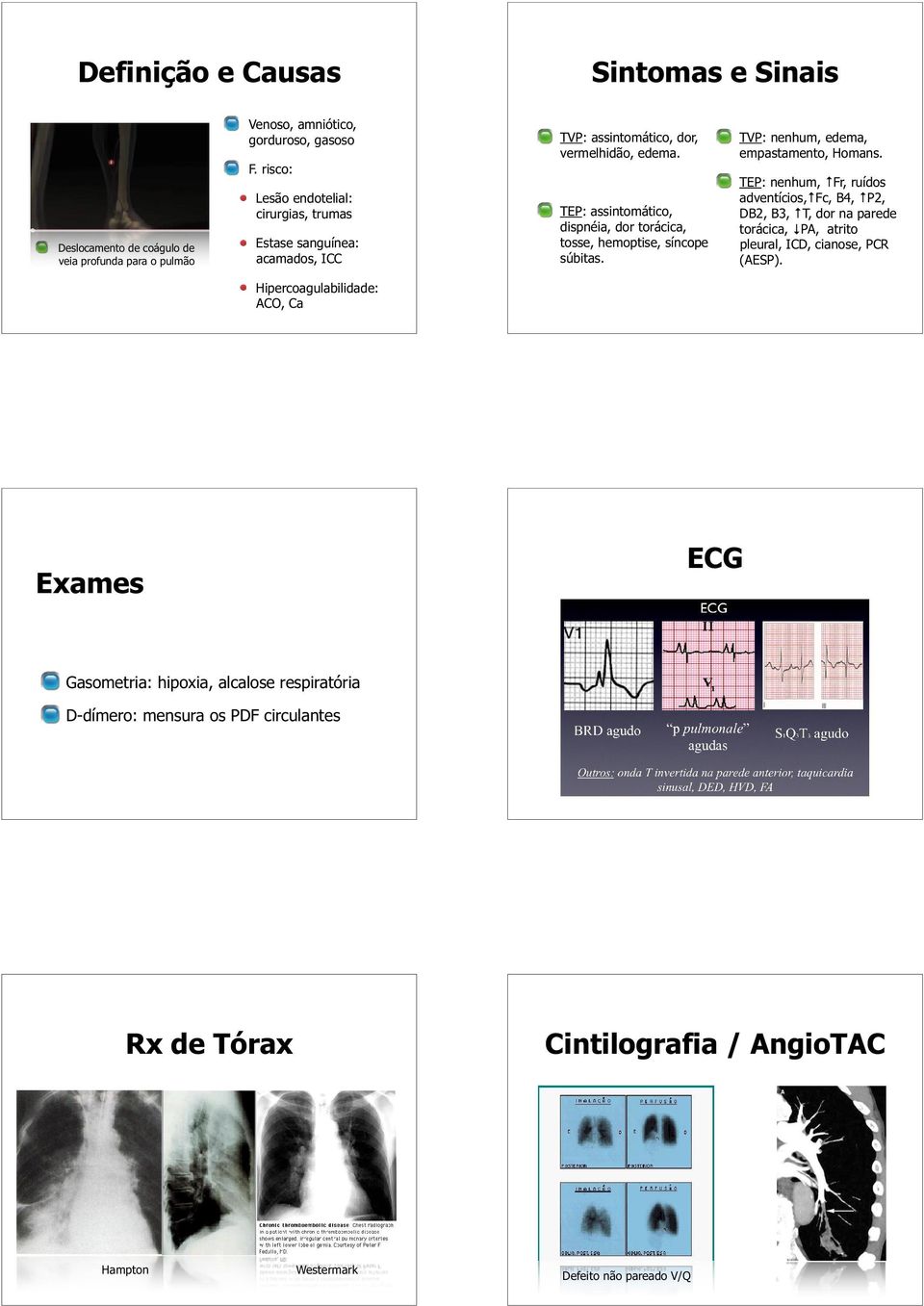 TEP: assintomático, dispnéia, dor torácica, tosse, hemoptise, síncope súbitas. TVP: nenhum, edema, empastamento, Homans.