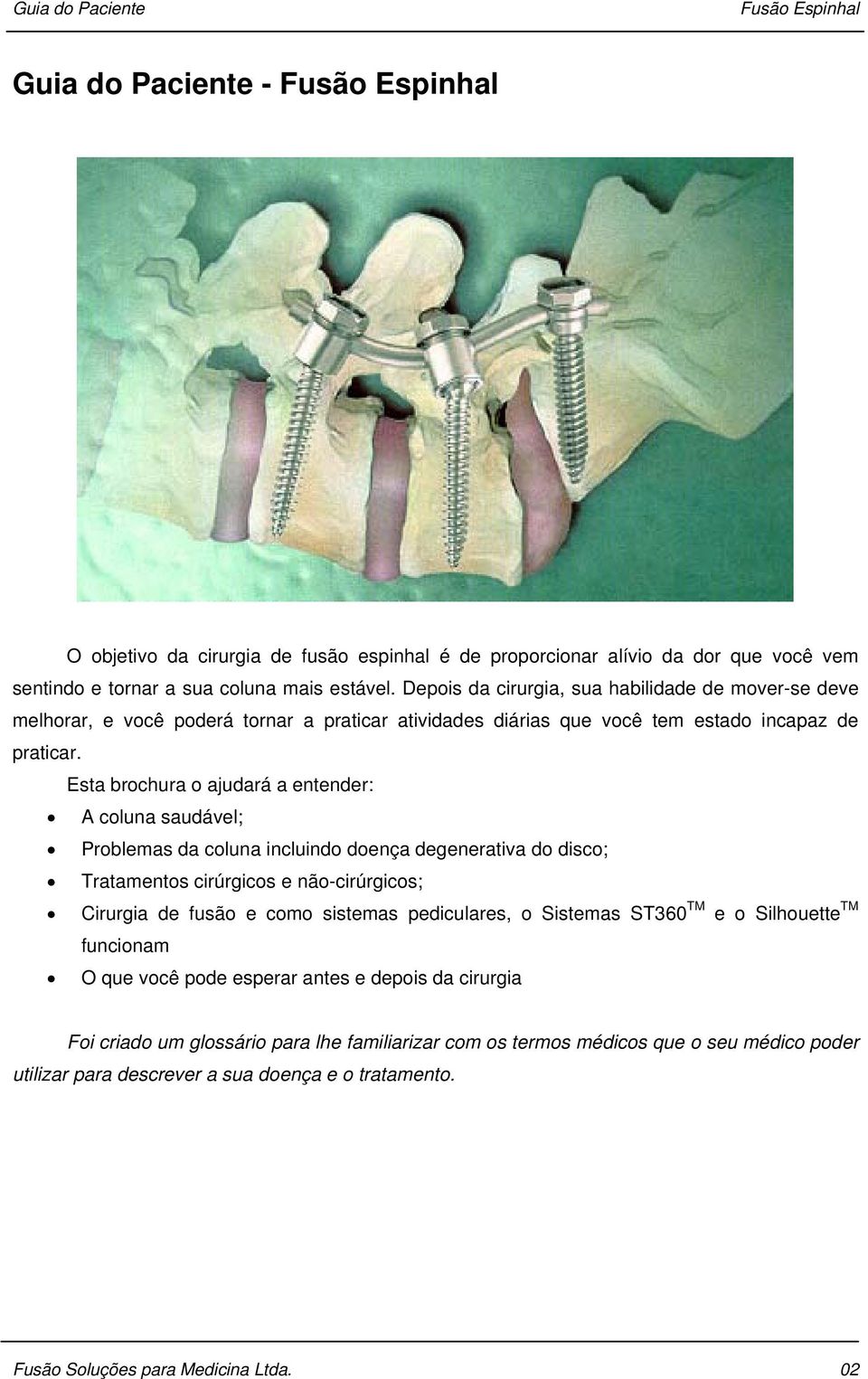 Esta brochura o ajudará a entender: A coluna saudável; Problemas da coluna incluindo doença degenerativa do disco; Tratamentos cirúrgicos e não-cirúrgicos; Cirurgia de fusão e como sistemas