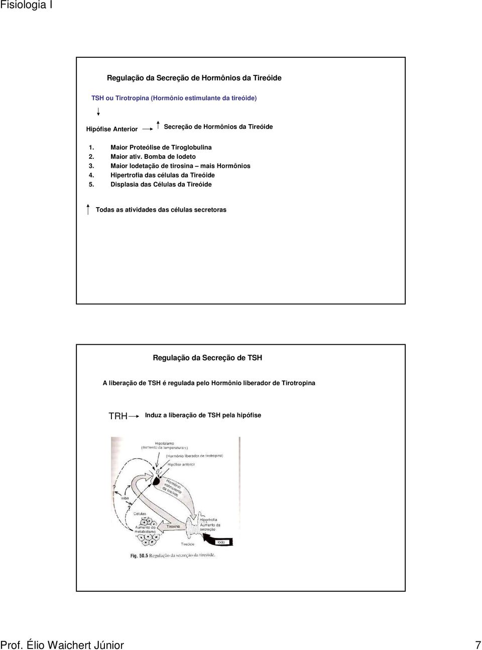 Hipertrofia das células da Tireóide 5.