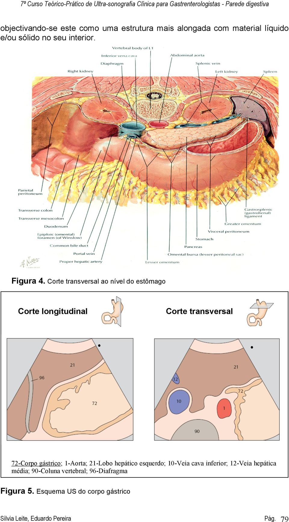 Corte transversal ao nível do estômago Corte longitudinal Corte transversal 72-Corpo gástrico; 1-Aorta; 21-Lobo hepático