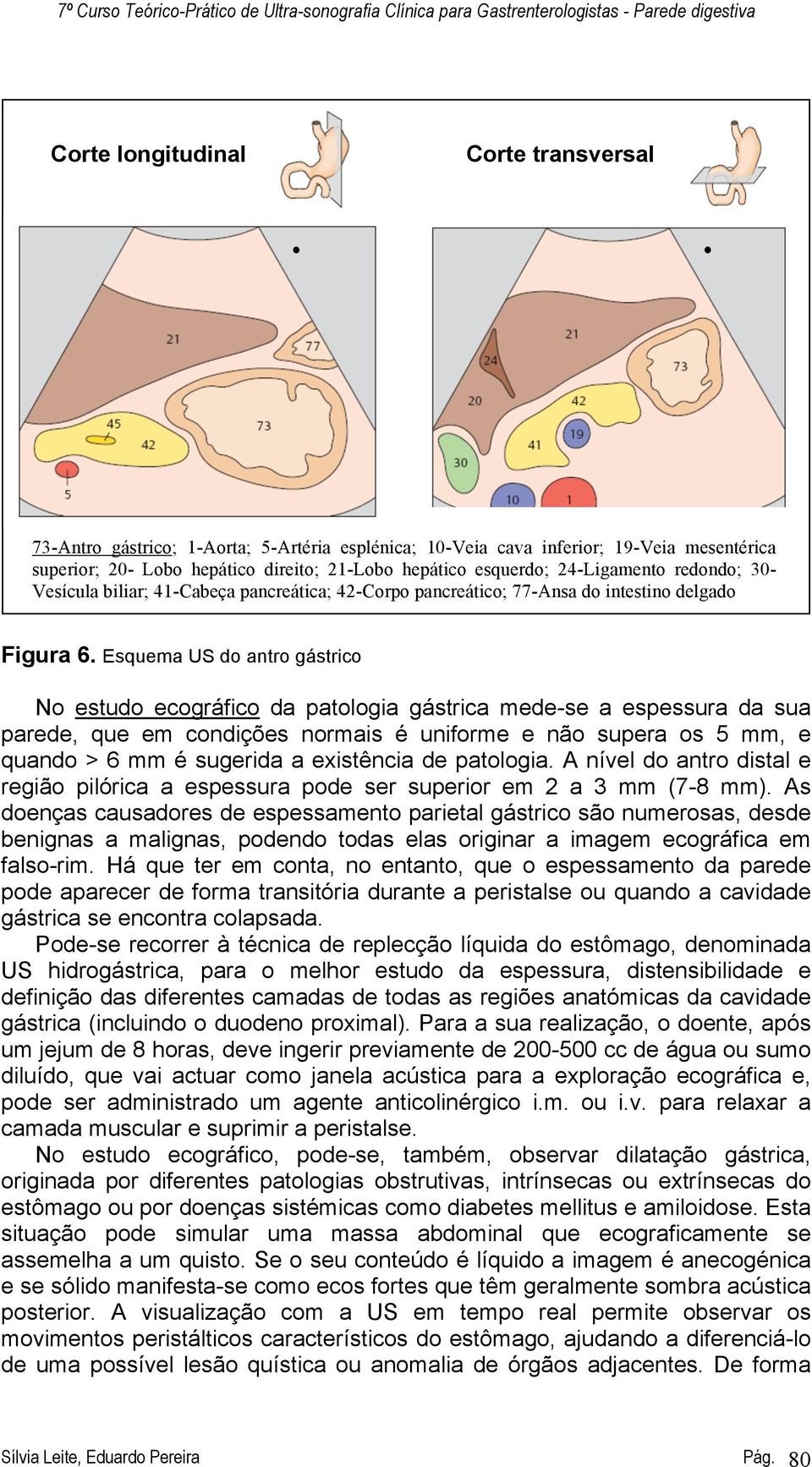 Esquema US do antro gástrico No estudo ecográfico da patologia gástrica mede-se a espessura da sua parede, que em condições normais é uniforme e não supera os 5 mm, e quando > 6 mm é sugerida a