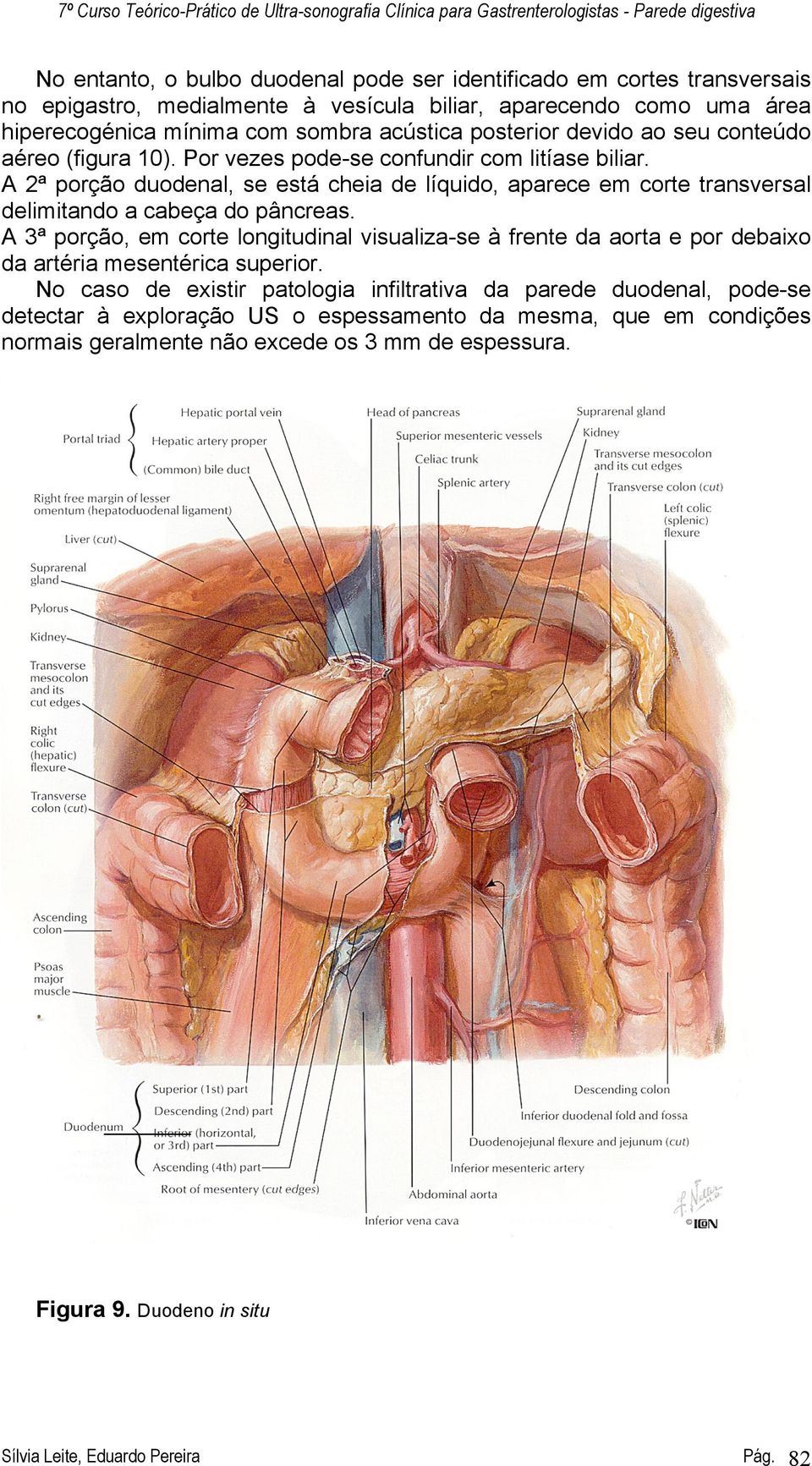 A 2ª porção duodenal, se está cheia de líquido, aparece em corte transversal delimitando a cabeça do pâncreas.