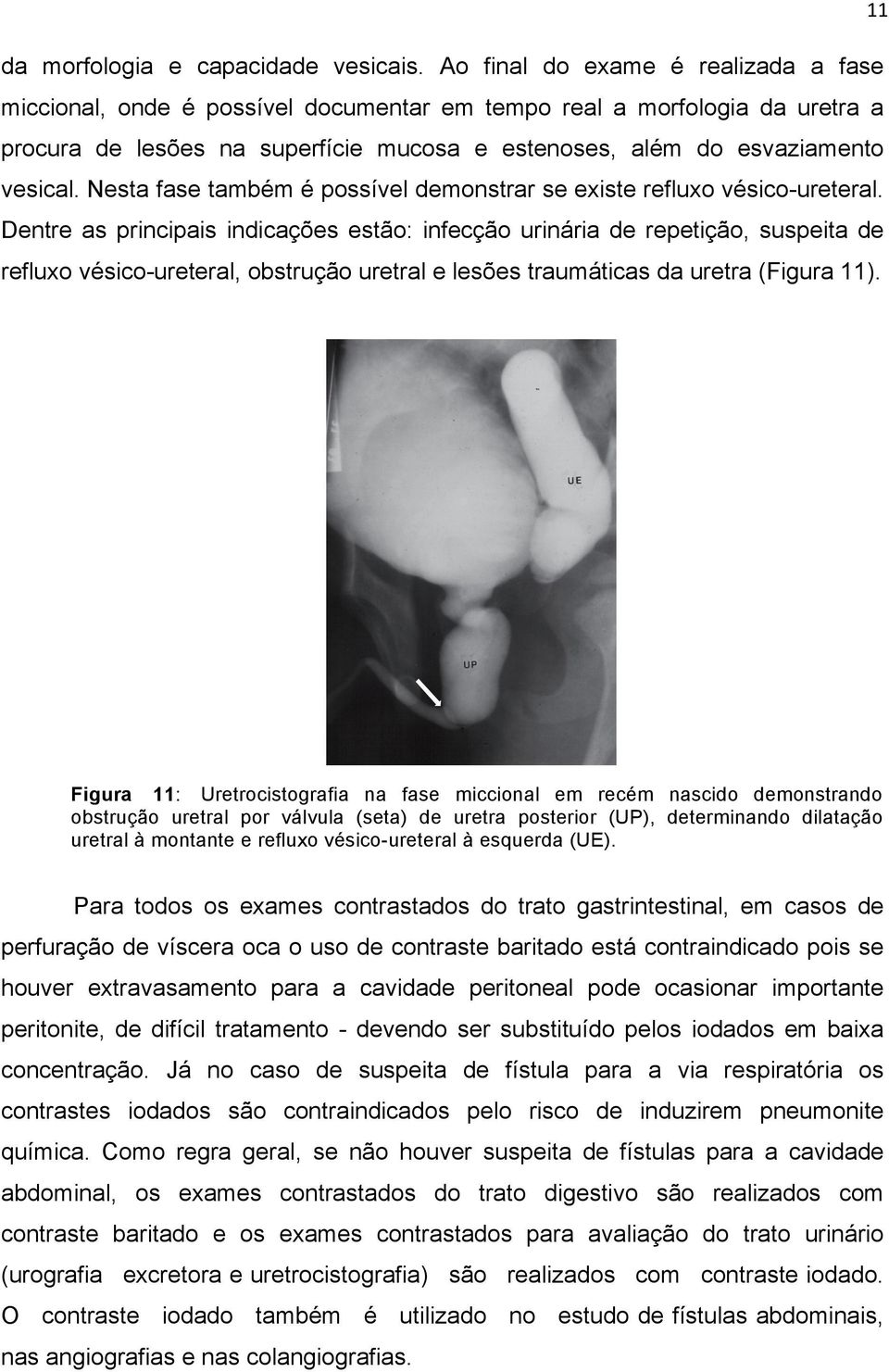 Nesta fase também é possível demonstrar se existe refluxo vésico-ureteral.