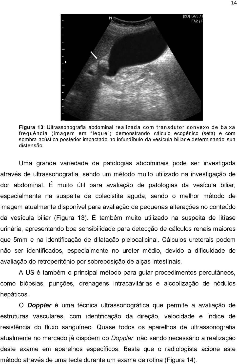 Uma grande variedade de patologias abdominais pode ser investigada através de ultrassonografia, sendo um método muito utilizado na investigação de dor abdominal.