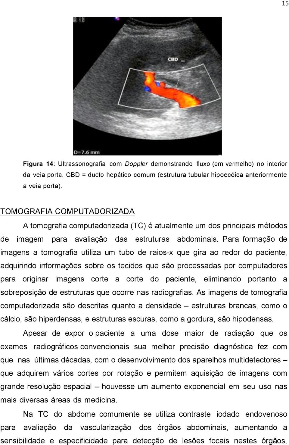 Para formação de imagens a tomografia utiliza um tubo de raios-x que gira ao redor do paciente, adquirindo informações sobre os tecidos que são processadas por computadores para originar imagens