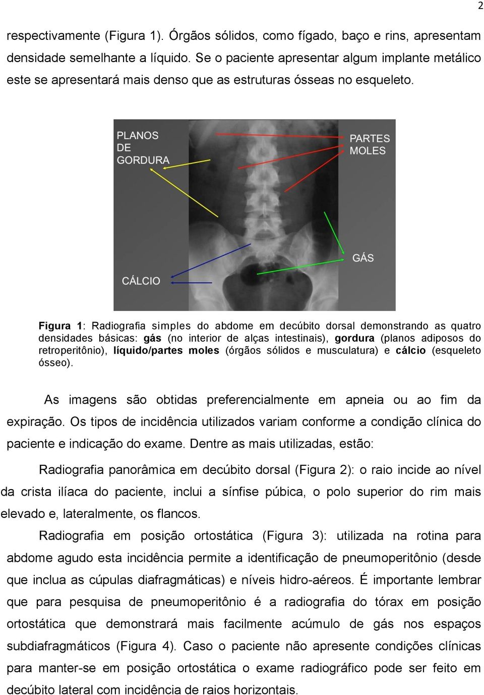 Figura 1: Radiografia simples do abdome em decúbito dorsal demonstrando as quatro densidades básicas: gás (no interior de alças intestinais), gordura (planos adiposos do retroperitônio),