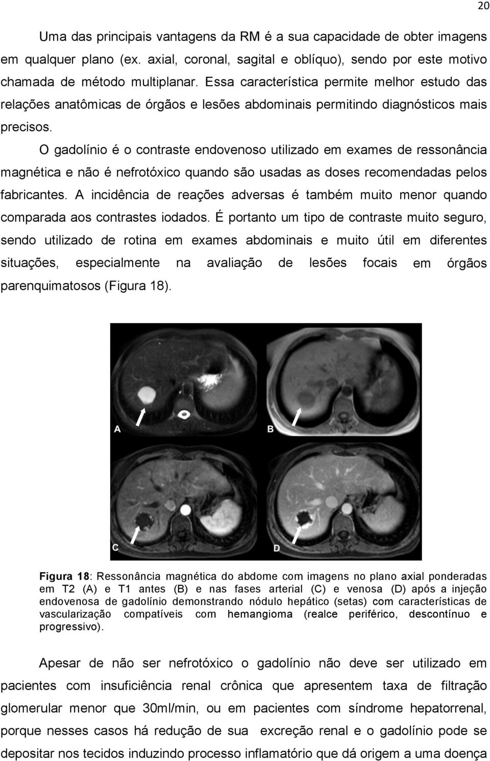 O gadolínio é o contraste endovenoso utilizado em exames de ressonância magnética e não é nefrotóxico quando são usadas as doses recomendadas pelos fabricantes.