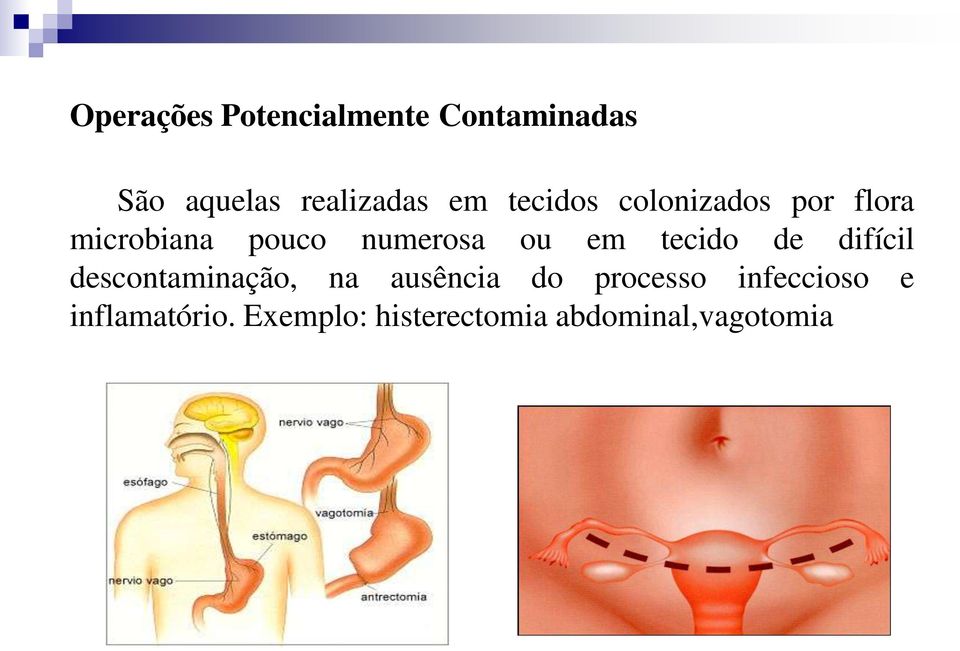 tecido de difícil descontaminação, na ausência do processo