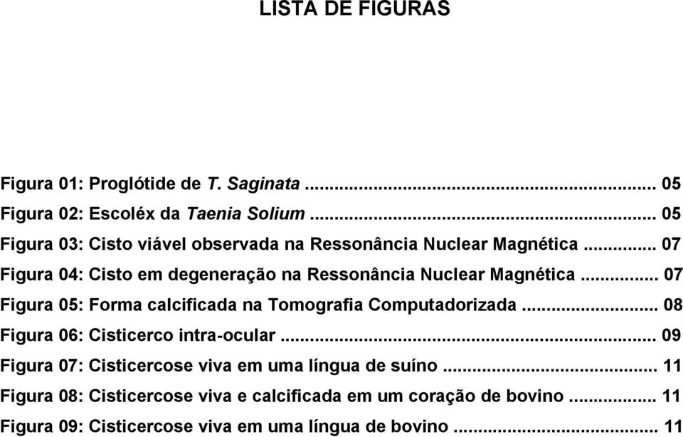 .. 07 Figura 04: Cisto em degeneração na Ressonância Nuclear Magnética... 07 Figura 05: Forma calcificada na Tomografia Computadorizada.