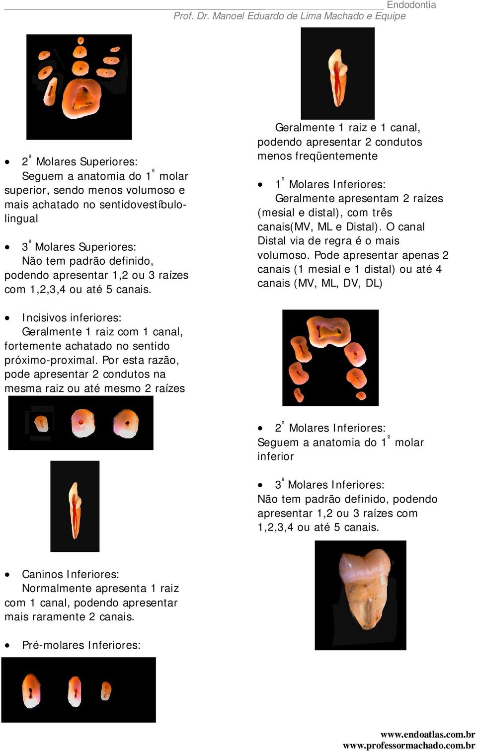 Geralmente 1 raiz e 1 canal, podendo apresentar 2 condutos menos freqüentemente 1 º Molares Inferiores: Geralmente apresentam 2 raízes (mesial e distal), com três canais(mv, ML e Distal).