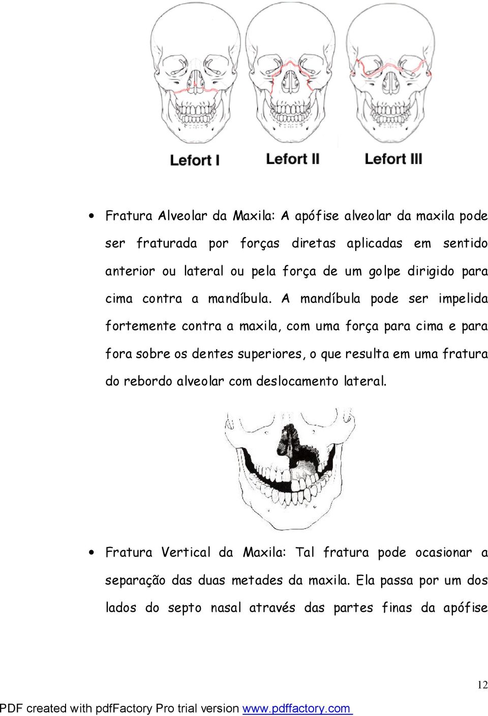 A mandíbula pode ser impelida fortemente contra a maxila, com uma força para cima e para fora sobre os dentes superiores, o que resulta em uma