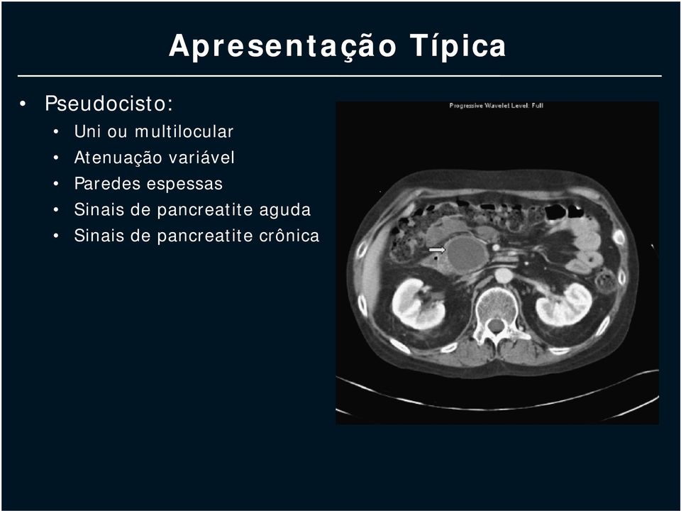 Apresentação Típica Sinais de