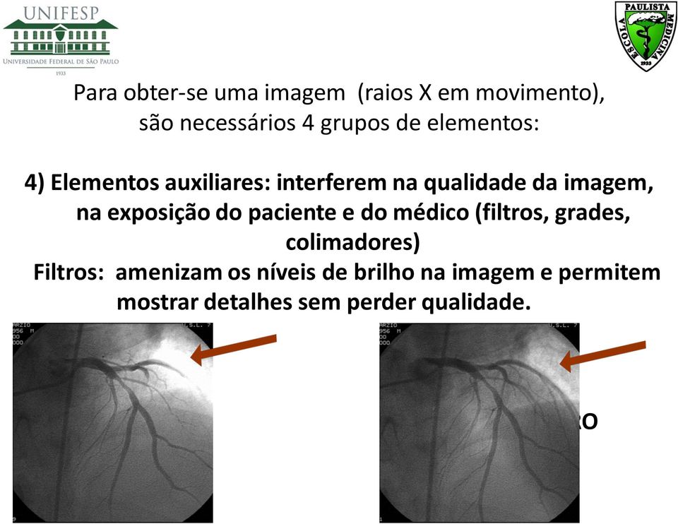 do paciente e do médico (filtros, grades, colimadores) Filtros: amenizam os níveis