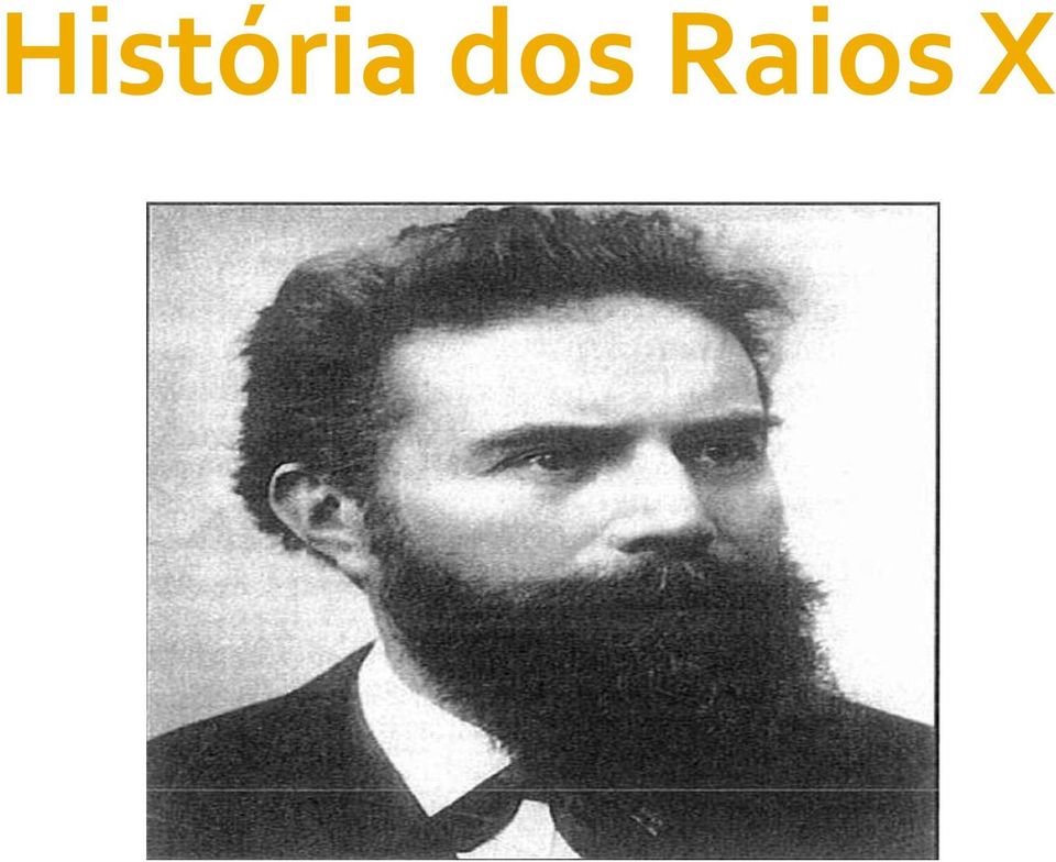 dos Raios X Pelo Professor de