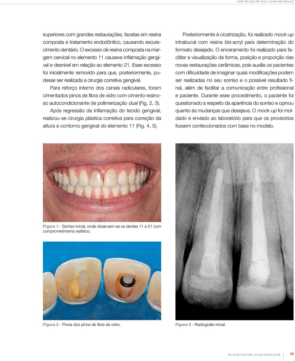 Esse excesso foi inicialmente removido para que, posteriormente, pudesse ser realizada a cirurgia corretiva gengival.