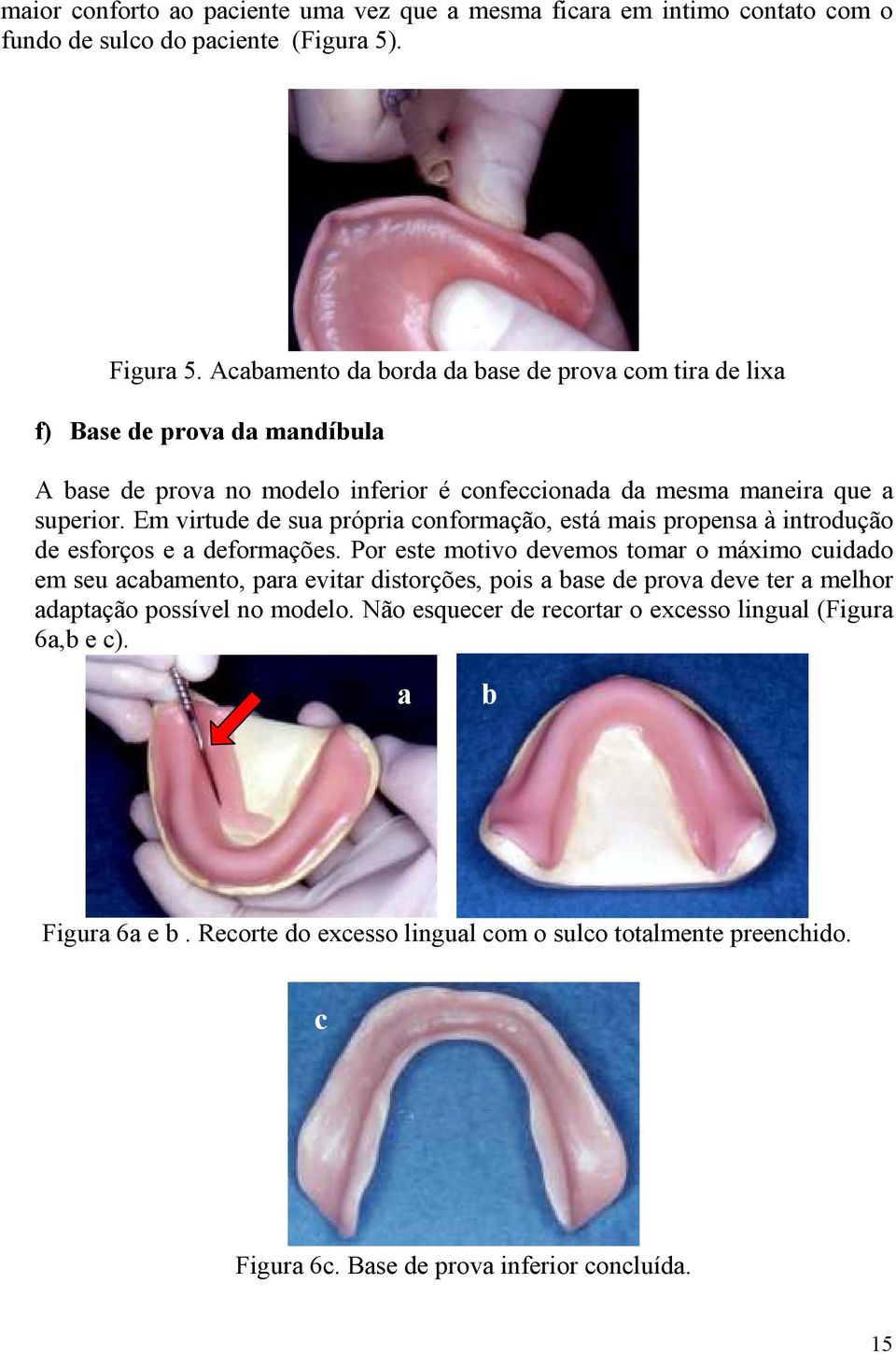 Em virtude de sua própria conformação, está mais propensa à introdução de esforços e a deformações.