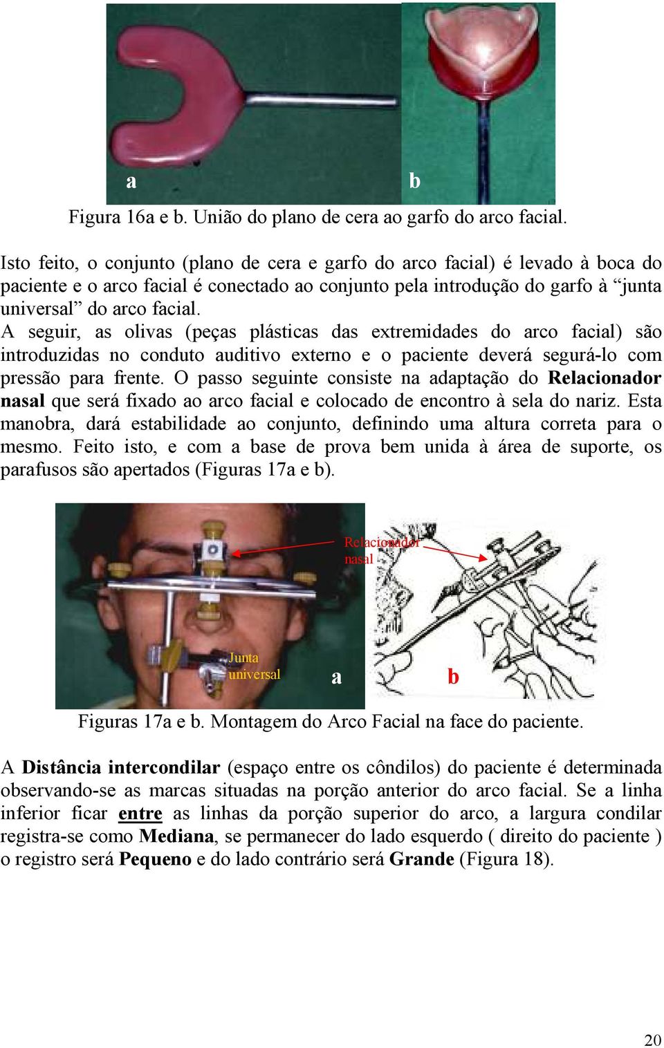 A seguir, as olivas (peças plásticas das extremidades do arco facial) são introduzidas no conduto auditivo externo e o paciente deverá segurá-lo com pressão para frente.