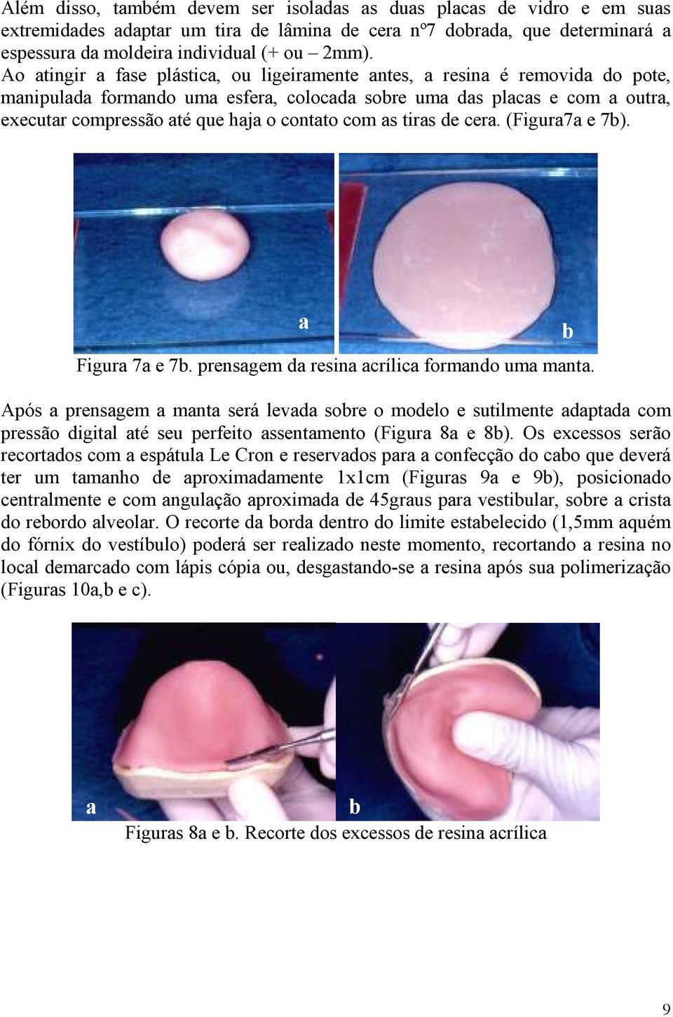 com as tiras de cera. (Figura7a e 7b). a Figura 7a e 7b. prensagem da resina acrílica formando uma manta.