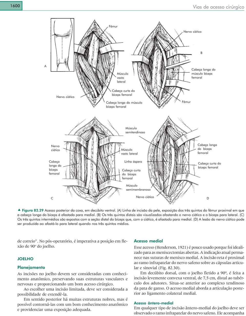 femoral D Figura 82.29 Acesso posterior da coxa, em decúbito ventral. (A) Linha de incisão da pele, exposição dos três quintos do fêmur proximal em que a cabeça longa do bíceps é afastada para medial.