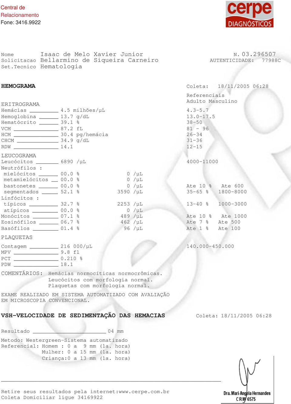 0 % 0 /µl metamielócitos 00.0 % 0 /µl bastonetes 00.0 % 0 /µl Ate 10 % Ate 600 segmentados 52.1 % 3590 /µl 35-65 % 1800-8000 Linfócitos : típicos 32.7 % 2253 /µl 13-40 % 1000-3000 atípicos 00.