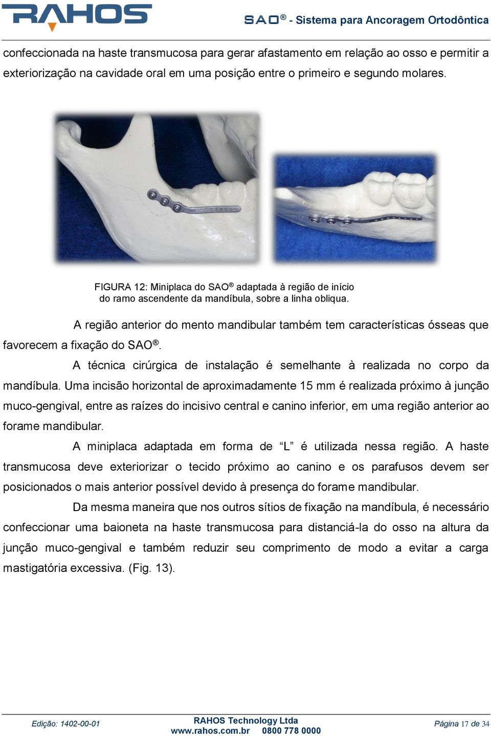 Uma incisão horizontal de aproximadamente 15 mm é realizada próximo à junção muco-gengival, entre as raízes do incisivo central e canino inferior, em uma região anterior ao forame mandibular.