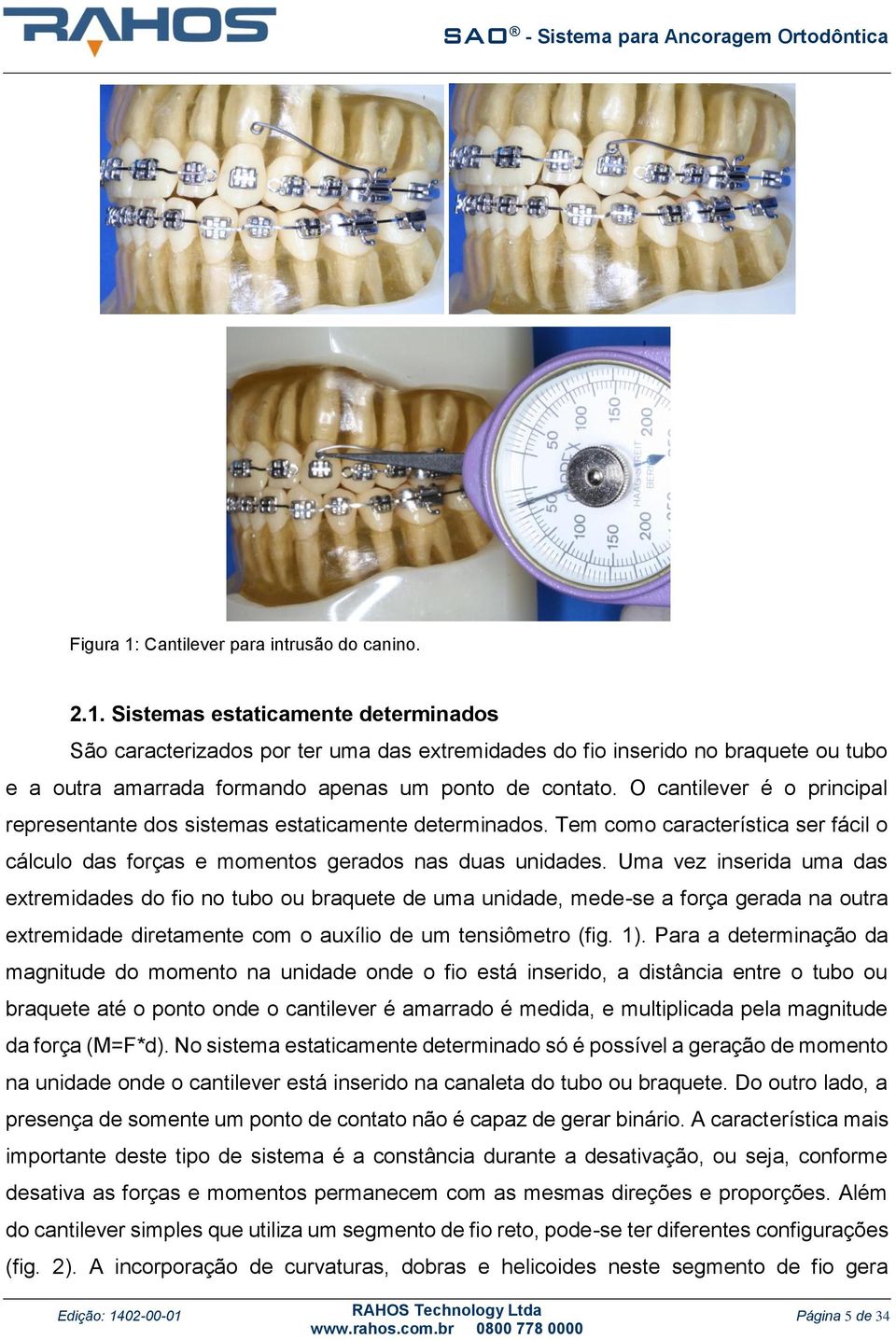 Uma vez inserida uma das extremidades do fio no tubo ou braquete de uma unidade, mede-se a força gerada na outra extremidade diretamente com o auxílio de um tensiômetro (fig. 1).