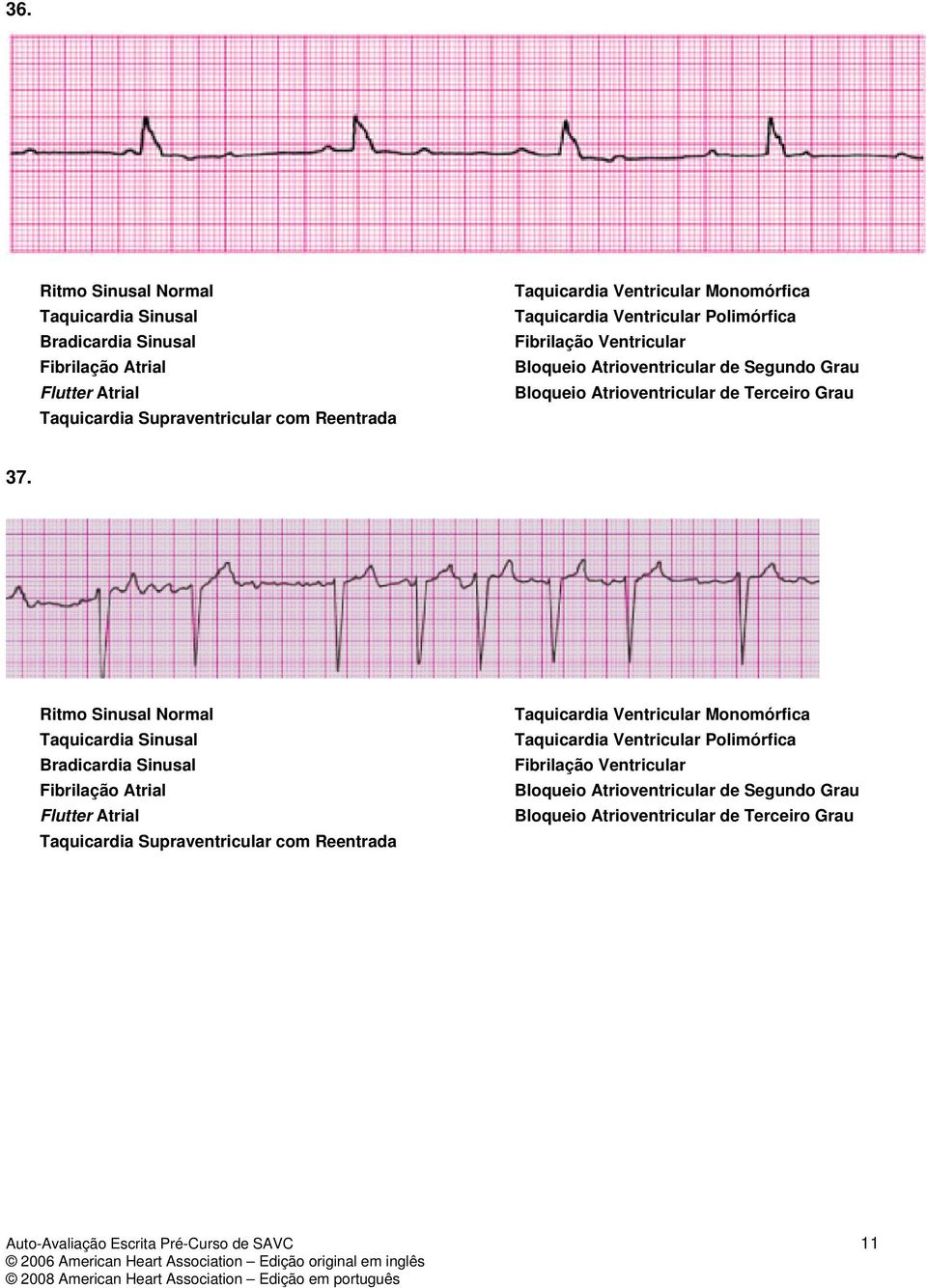 Ritmo Sinusal Normal Taquicardia Sinusal Bradicardia Sinusal Fibrilação Atrial Flutter Atrial Taquicardia Supraventricular com Reentrada Taquicardia Ventricular Monomórfica Taquicardia Ventricular