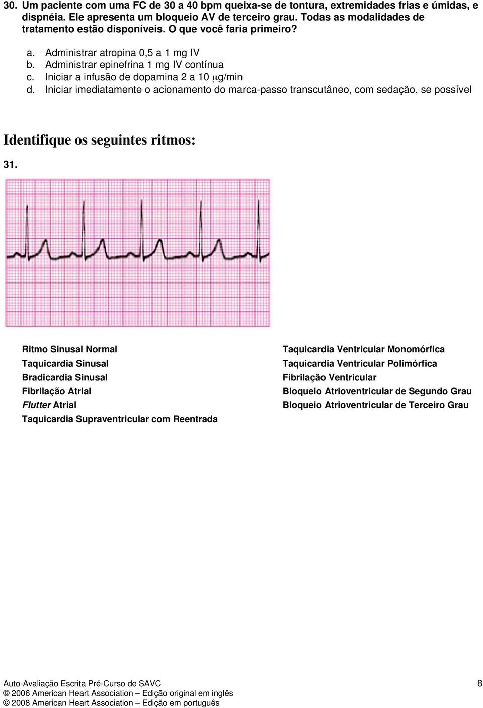 Iniciar a infusão de dopamina 2 a 10 μg/min d. Iniciar imediatamente o acionamento do marca-passo transcutâneo, com sedação, se possível Identifique os seguintes ritmos: 31.