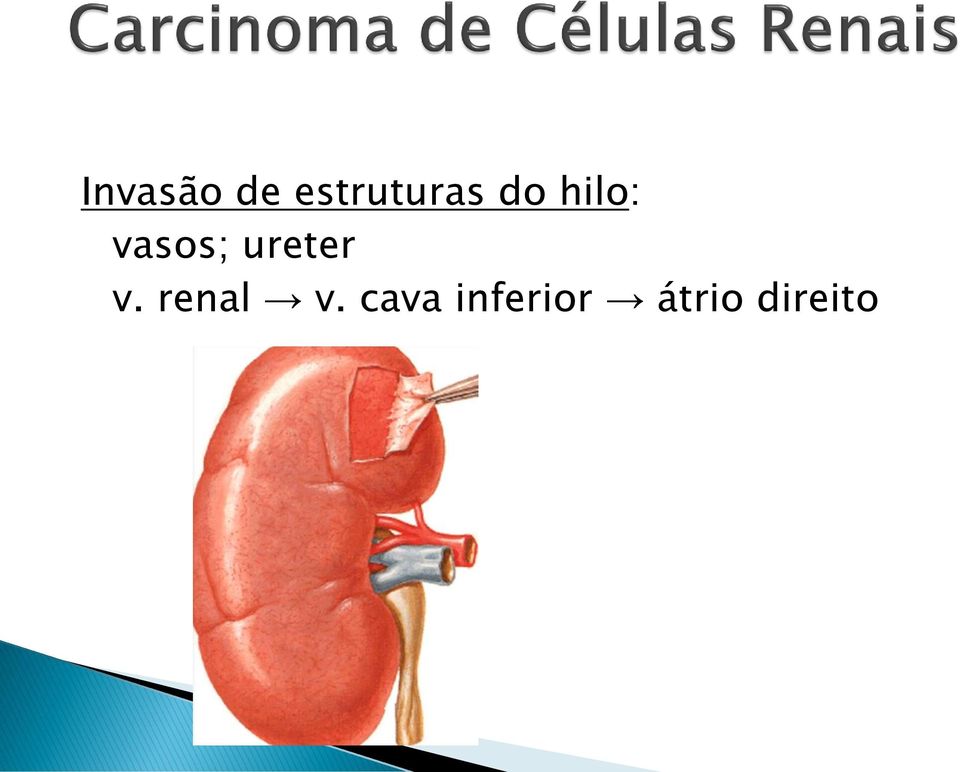 vasos; ureter v.