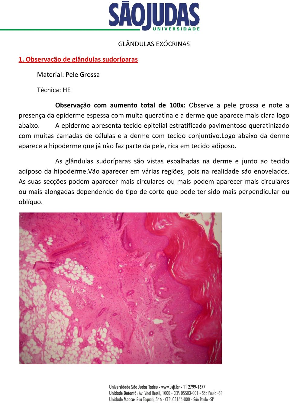 A epiderme apresenta tecido epitelial estratificado pavimentoso queratinizado com muitas camadas de células e a derme com tecido conjuntivo.