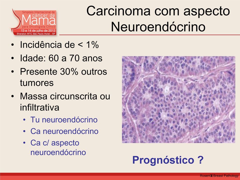 circunscrita ou infiltrativa Tu neuroendócrino Ca