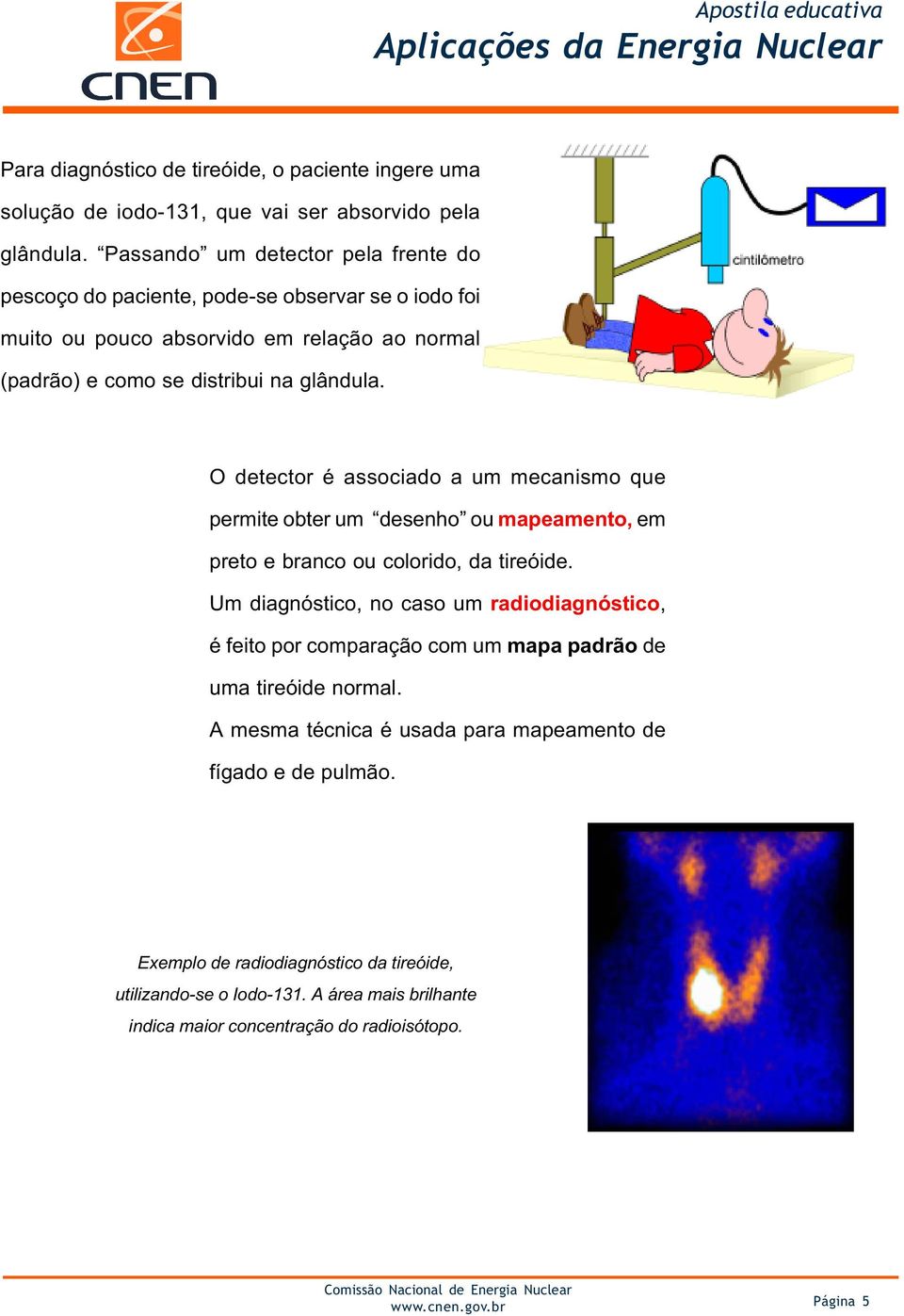 O detector é associado a um mecanismo que permite obter um desenho ou mapeamento, em preto e branco ou colorido, da tireóide.