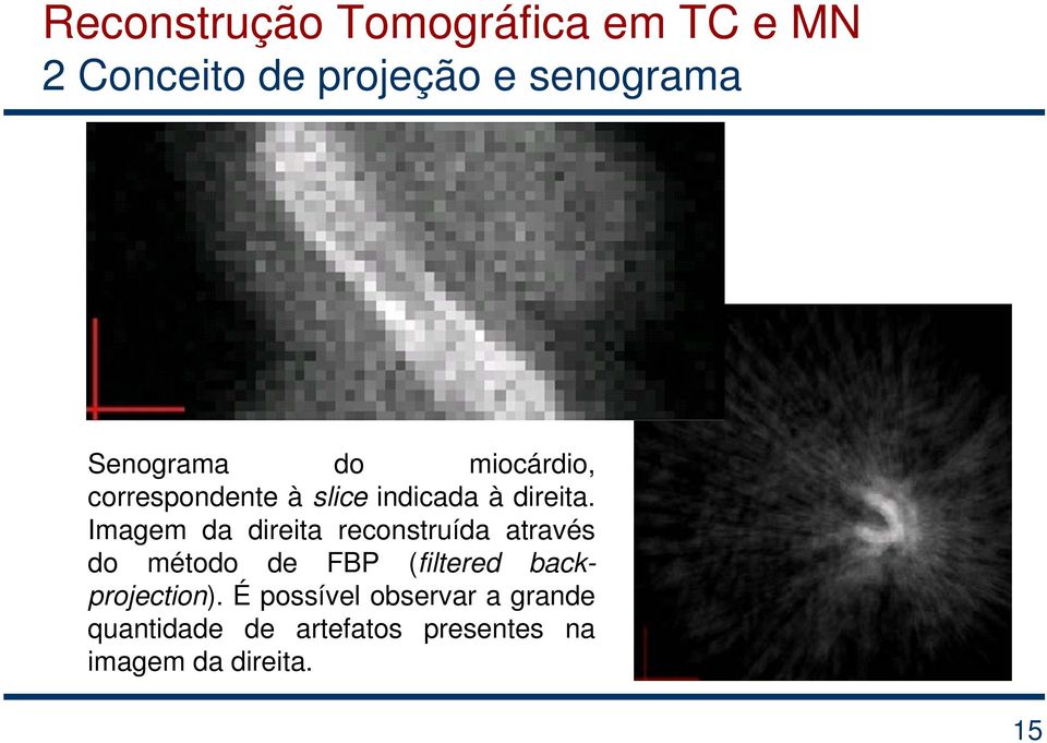 Imagem da direita reconstruída através do método de FBP (filtered