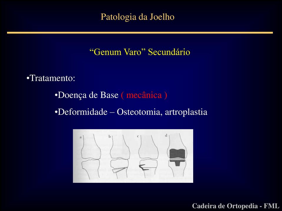 Base ( mecânica )