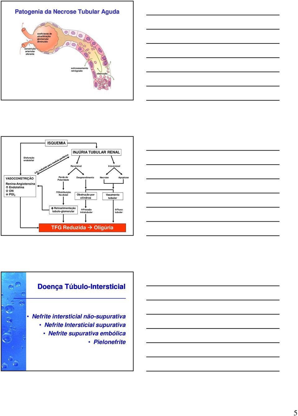 Distribuição Na distal Desprendimento Necrose Apoptose Obstrução por cilindros Vasamento tubular Retroalimentação tubulo-glomerular Pressão intratubular