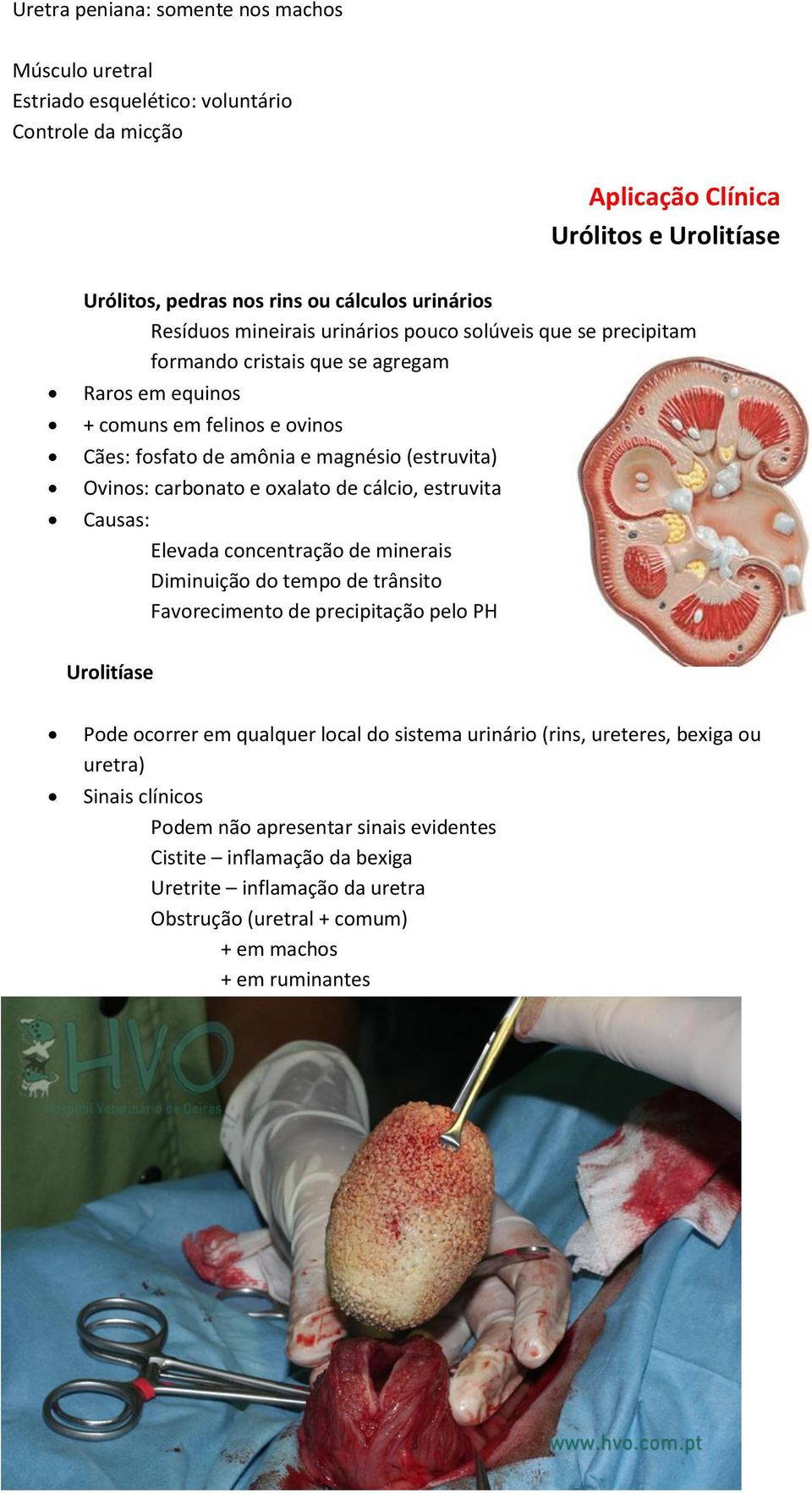 oxalato de cálcio, estruvita Causas: Elevada concentração de minerais Diminuição do tempo de trânsito Favorecimento de precipitação pelo PH Urolitíase Pode ocorrer em qualquer local do sistema