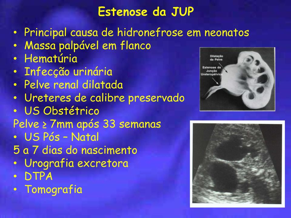 Ureteres de calibre preservado US Obstétrico Pelve 7mm após 33