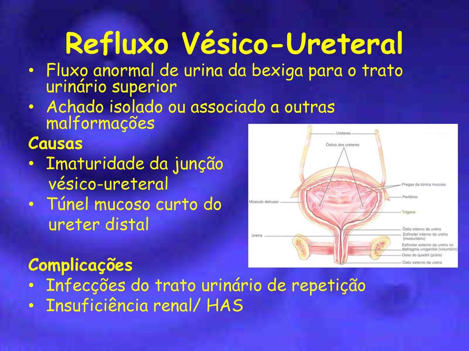 Imaturidade da junção vésico-ureteral Túnel mucoso curto do ureter distal