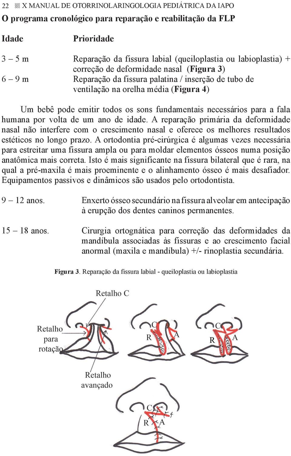 para a fala humana por volta de um ano de idade. A reparação primária da deformidade nasal não interfere com o crescimento nasal e oferece os melhores resultados estéticos no longo prazo.